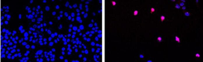 AOH1996 programmed cell death